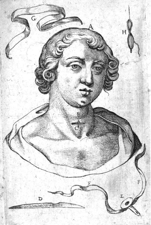 Nicholas-Habicot,-Question-chriurgicale,-1620